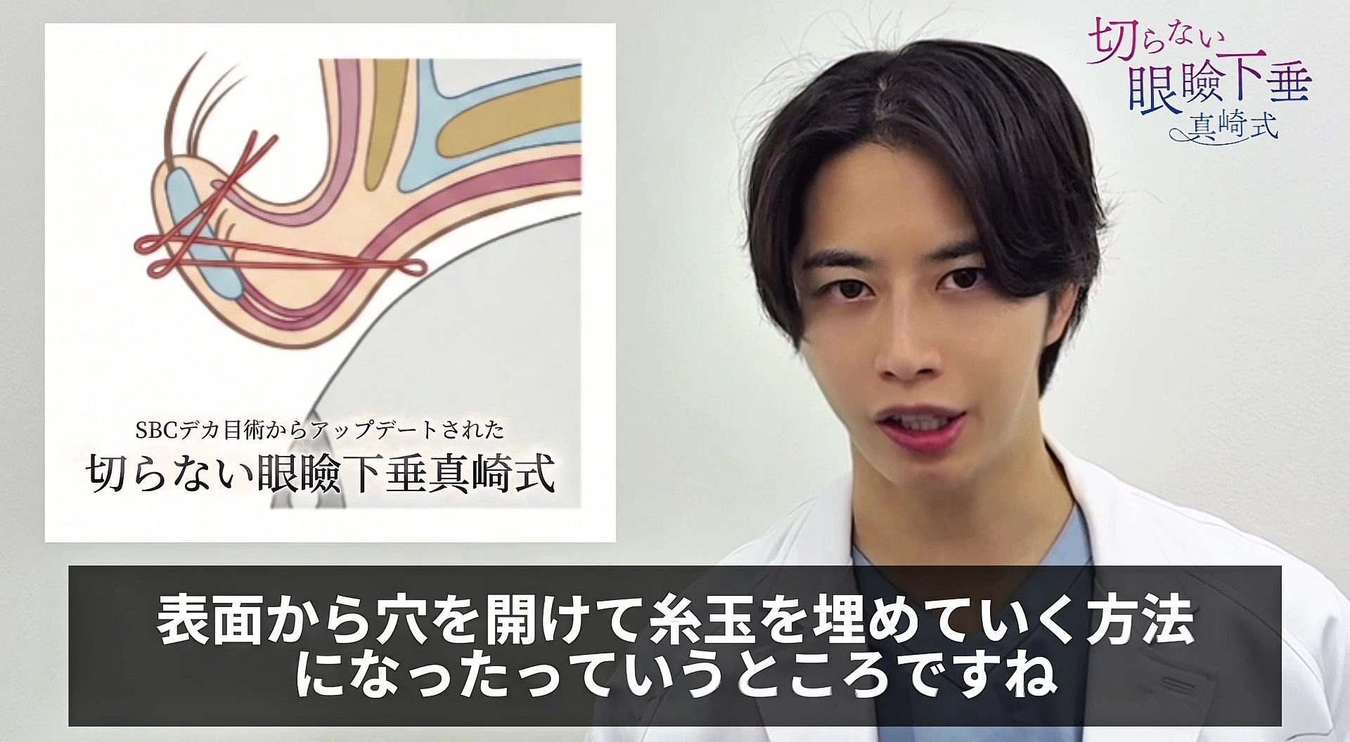 🪡表面から糸玉を埋める手法へ進化