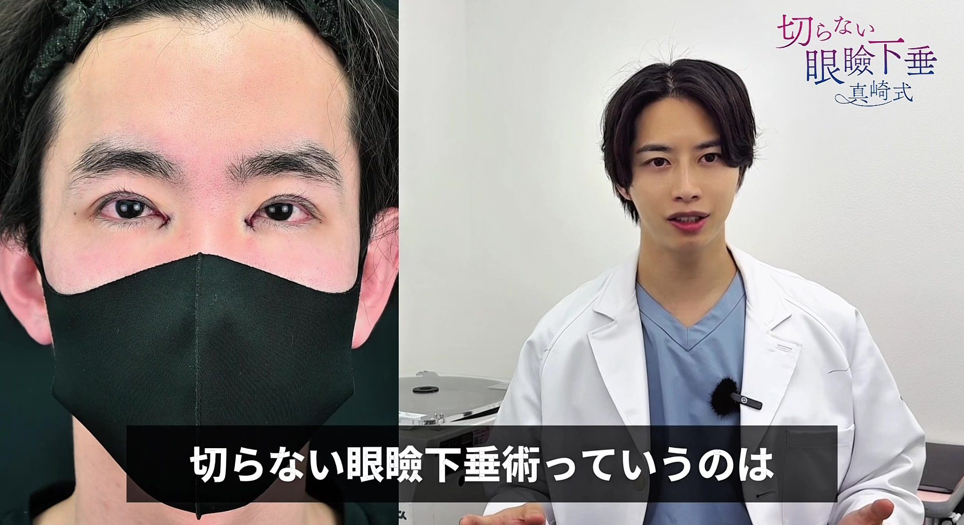 ✨術後直後〜1ヶ月の経過