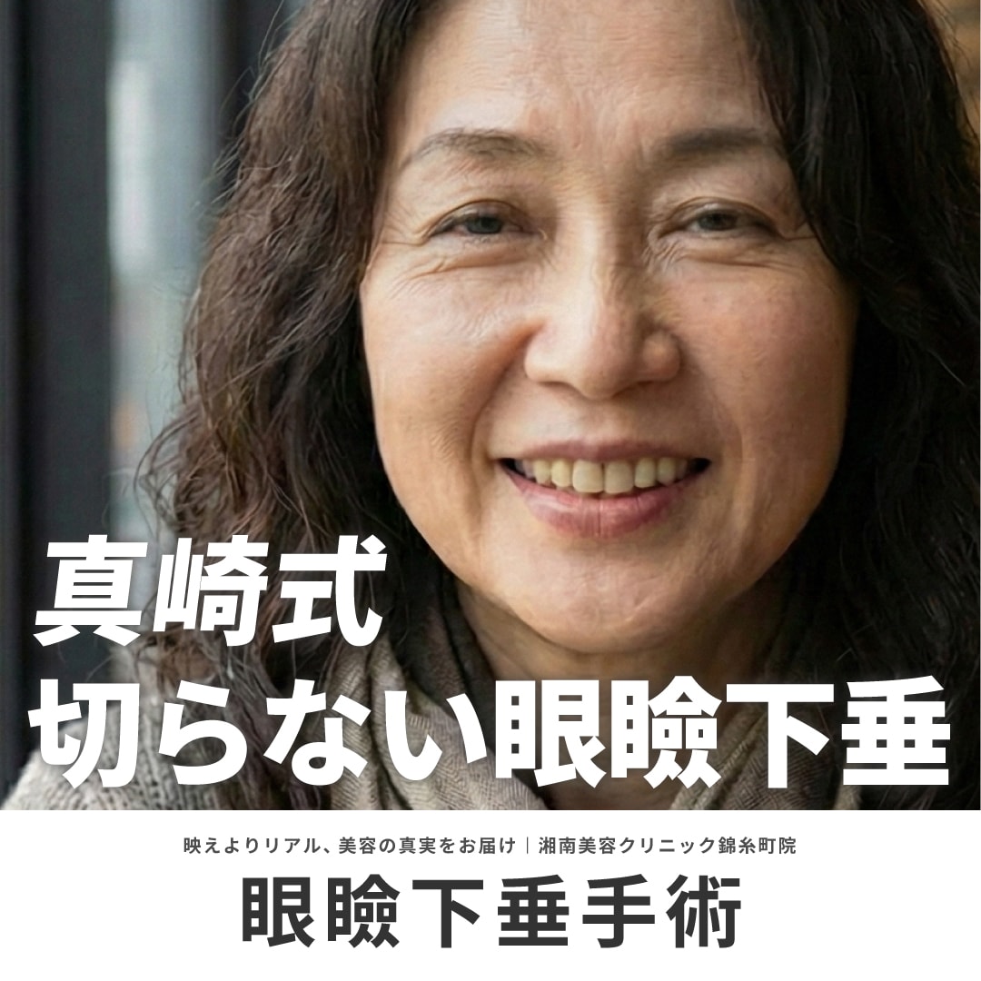 真崎式切らない眼瞼下垂について解説！ダウンタイム・効果・メリットとデメリット｜湘南美容クリニック錦糸町院中山昌大医師