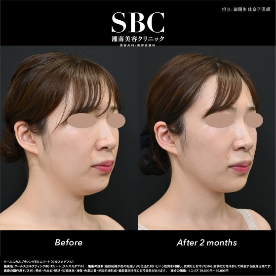 リアルな変化をチェック！✨