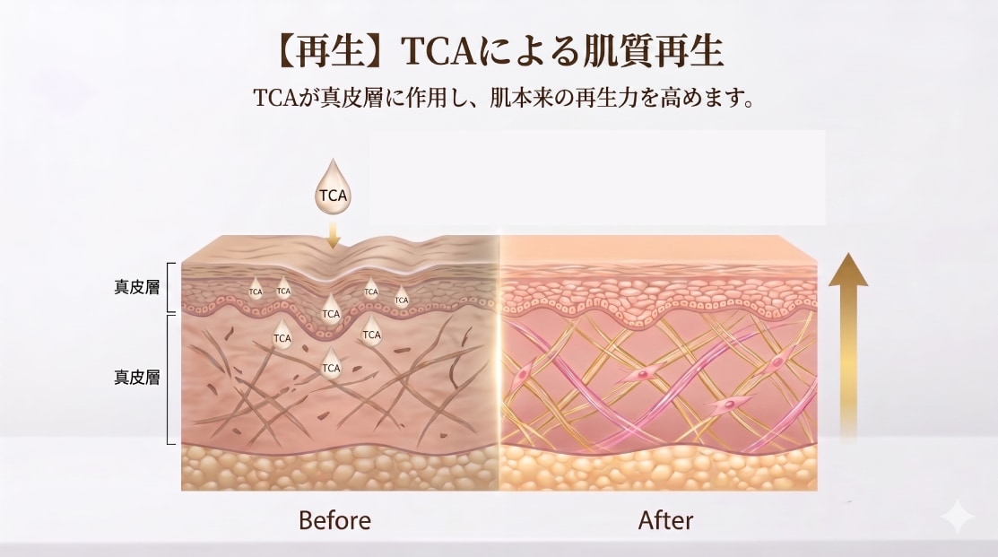 【再生】TCAによる肌質改善