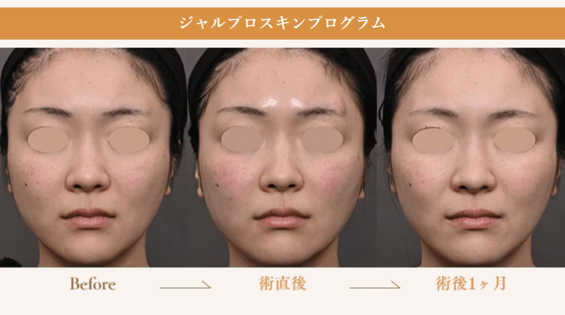 驚きの変化！ビフォーアフター