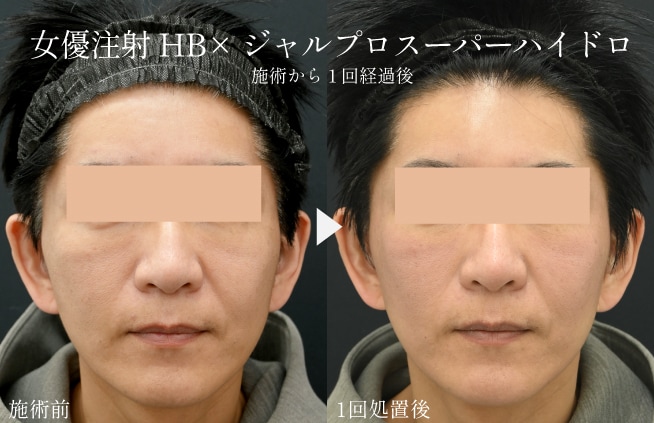 ツヤ肌