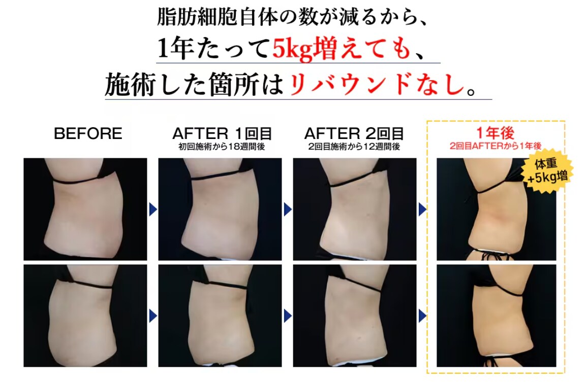 3. 脂肪細胞そのものが減る＝リバウンド地獄からの卒業！