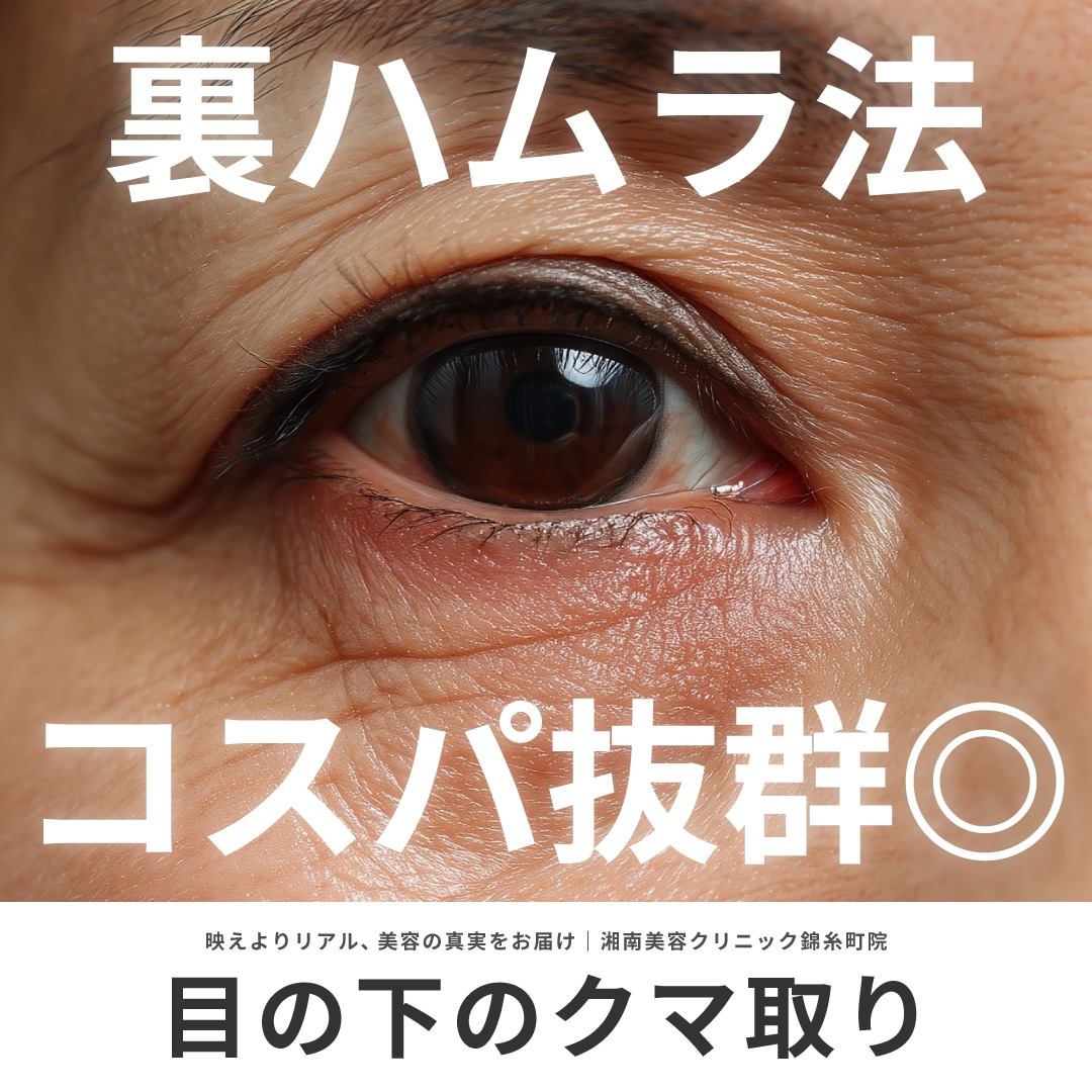クマ取り・裏ハムラを安くお得に東京都内で受けるなら錦糸町院｜湘南美容クリニック