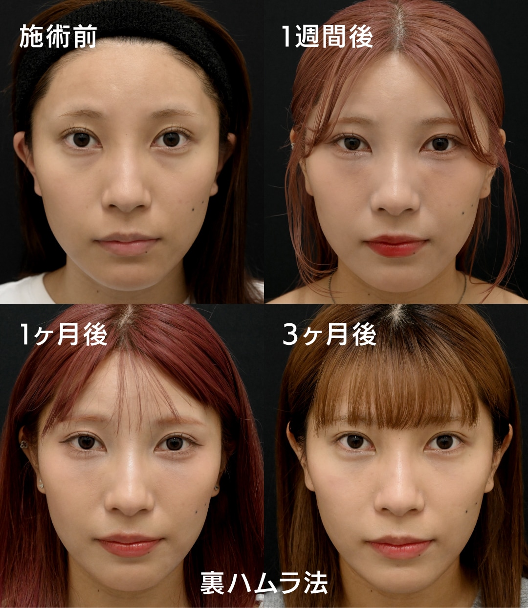 疲れた印象が激変！ビフォーアフター