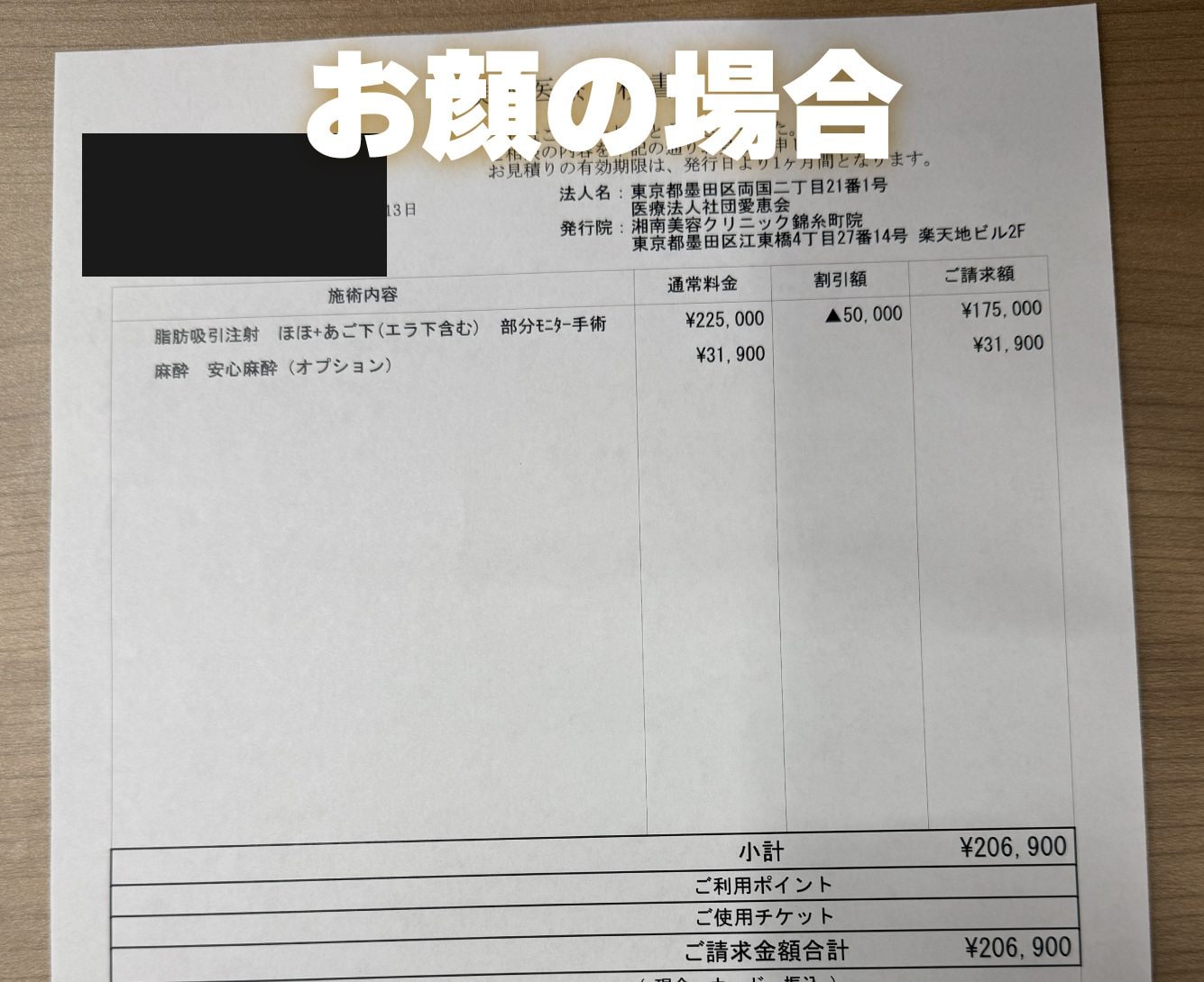 ① SBC錦糸町は無理なアップセルなし！カウンセリングは何度でも「完全無料」 🤝