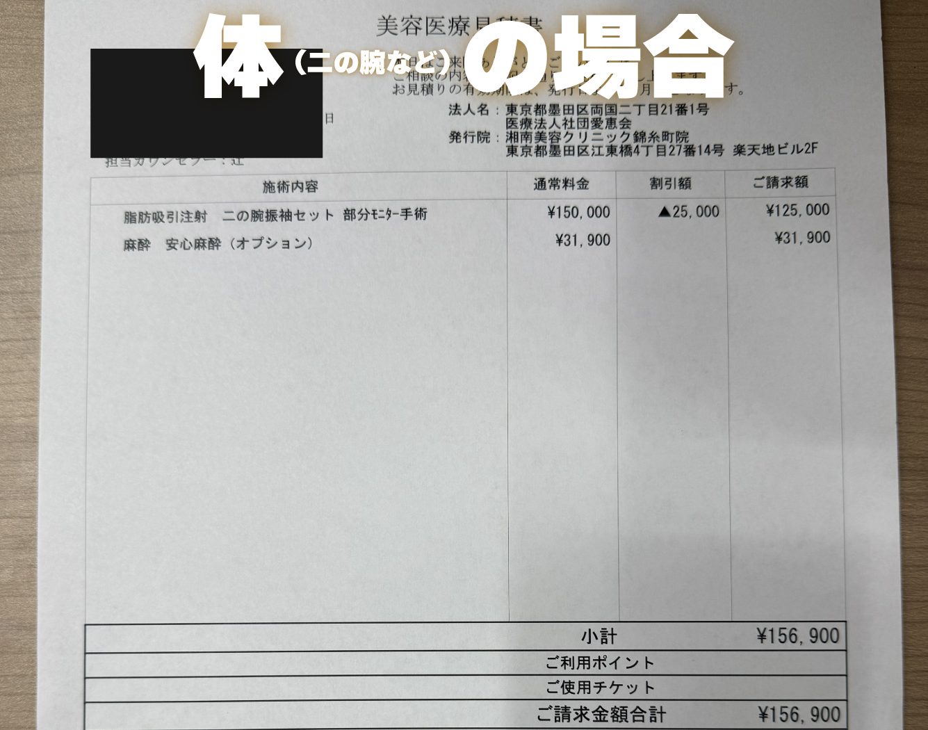 ② 「固定バンドの強制購入」「サポーター」などの隠れた罠がありません 🛡️