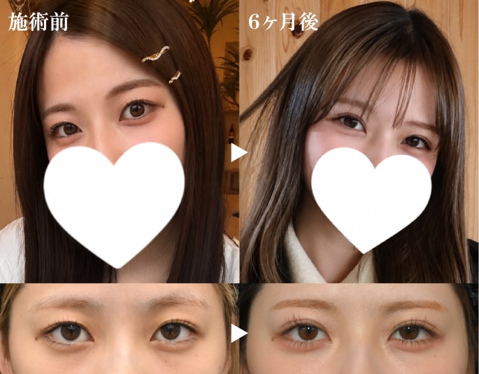 「今日が一番可愛い」を一生モノに！まずは無料シミュレーションへ