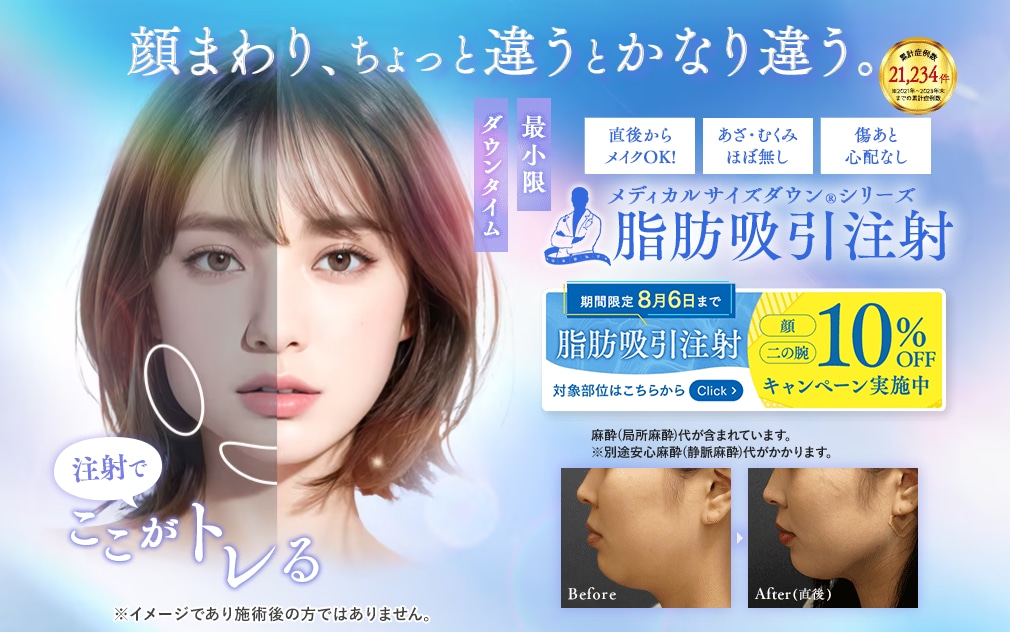 ダウンタイムを極限まで抑える「脂肪吸引注射」