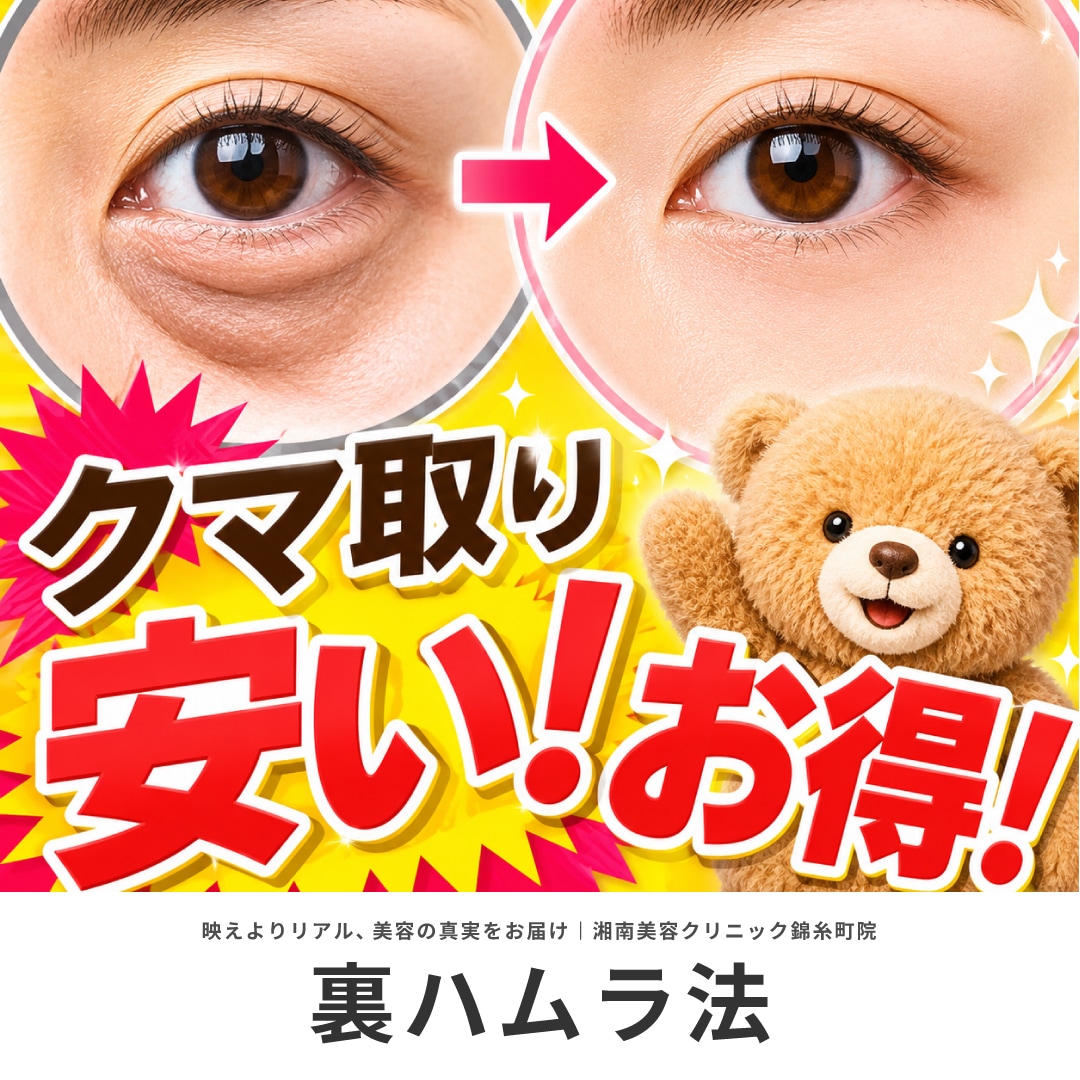 裏ハムラ法をお得に安く受ける方法5選!モニターの条件や賢いクリニック選びを解説【湘南美容クリニック錦糸町院】