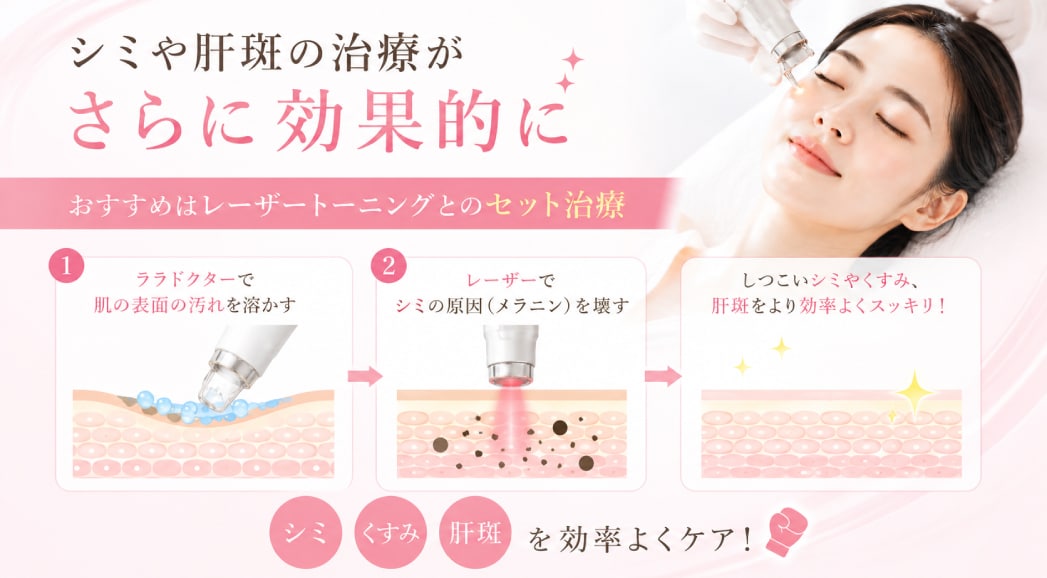 シミや肝斑の治療がさらに効果的に