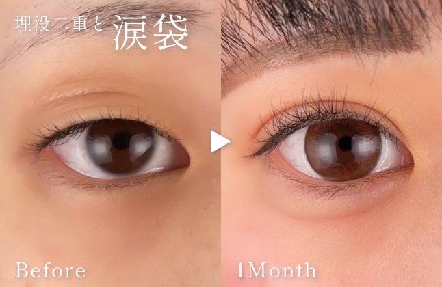 上下から目を大きく見せる最強の組み合わせ