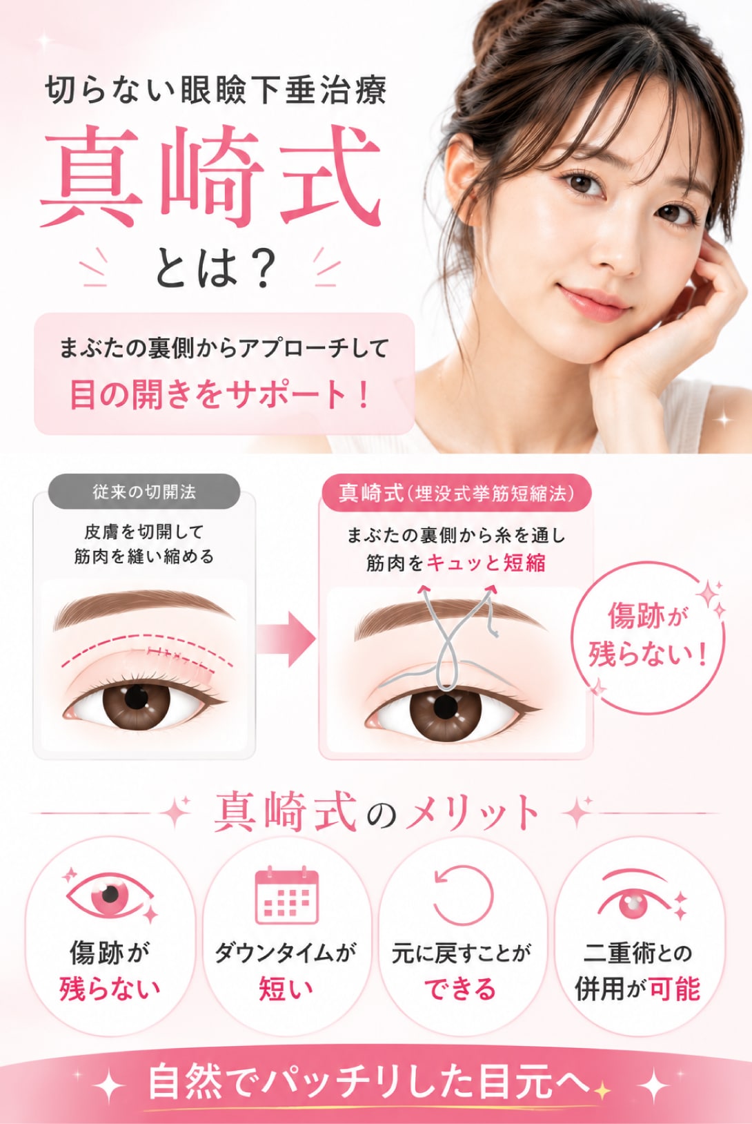 切らない眼瞼下垂 真崎式