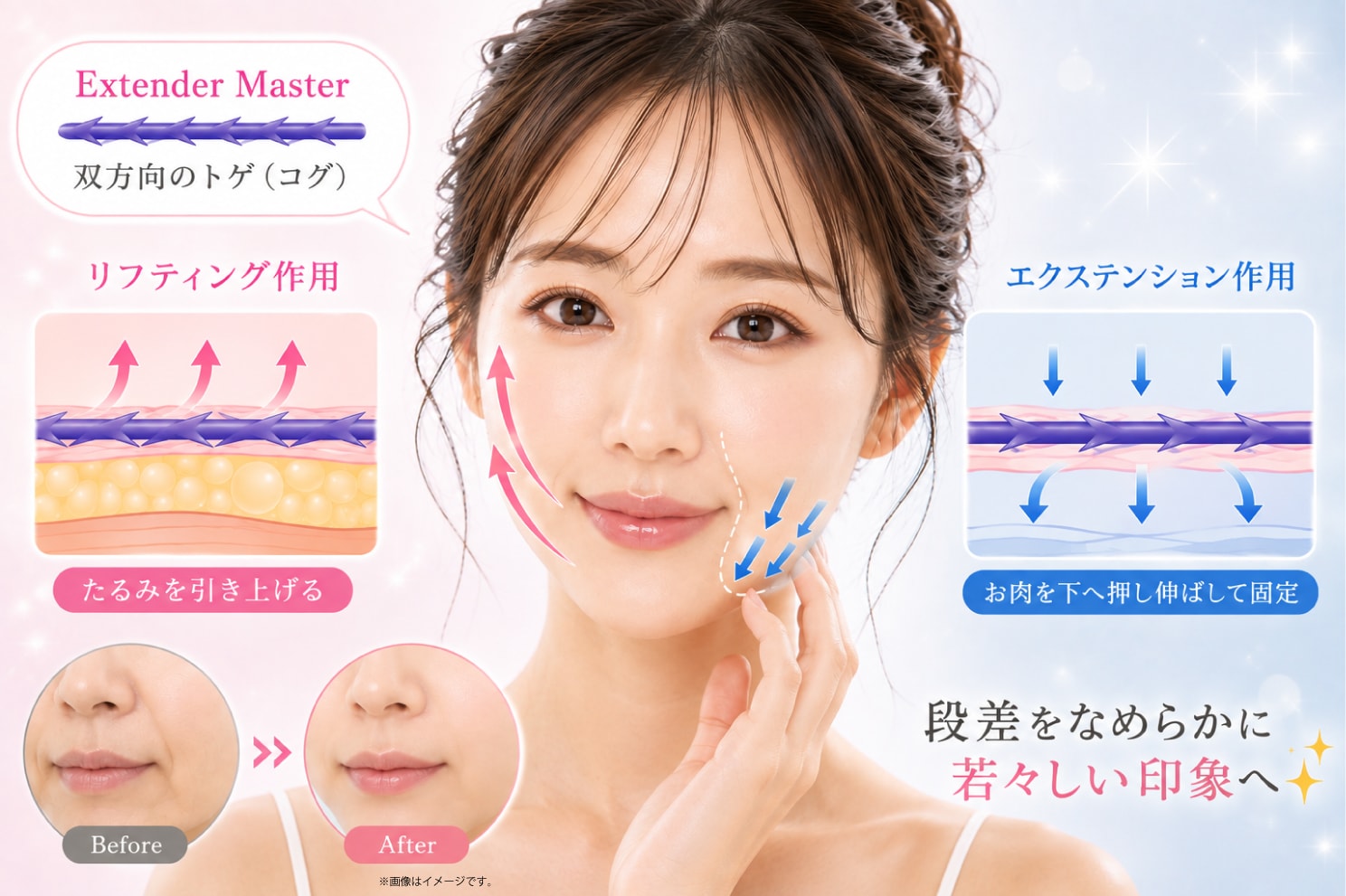 Extender Master 仕組み