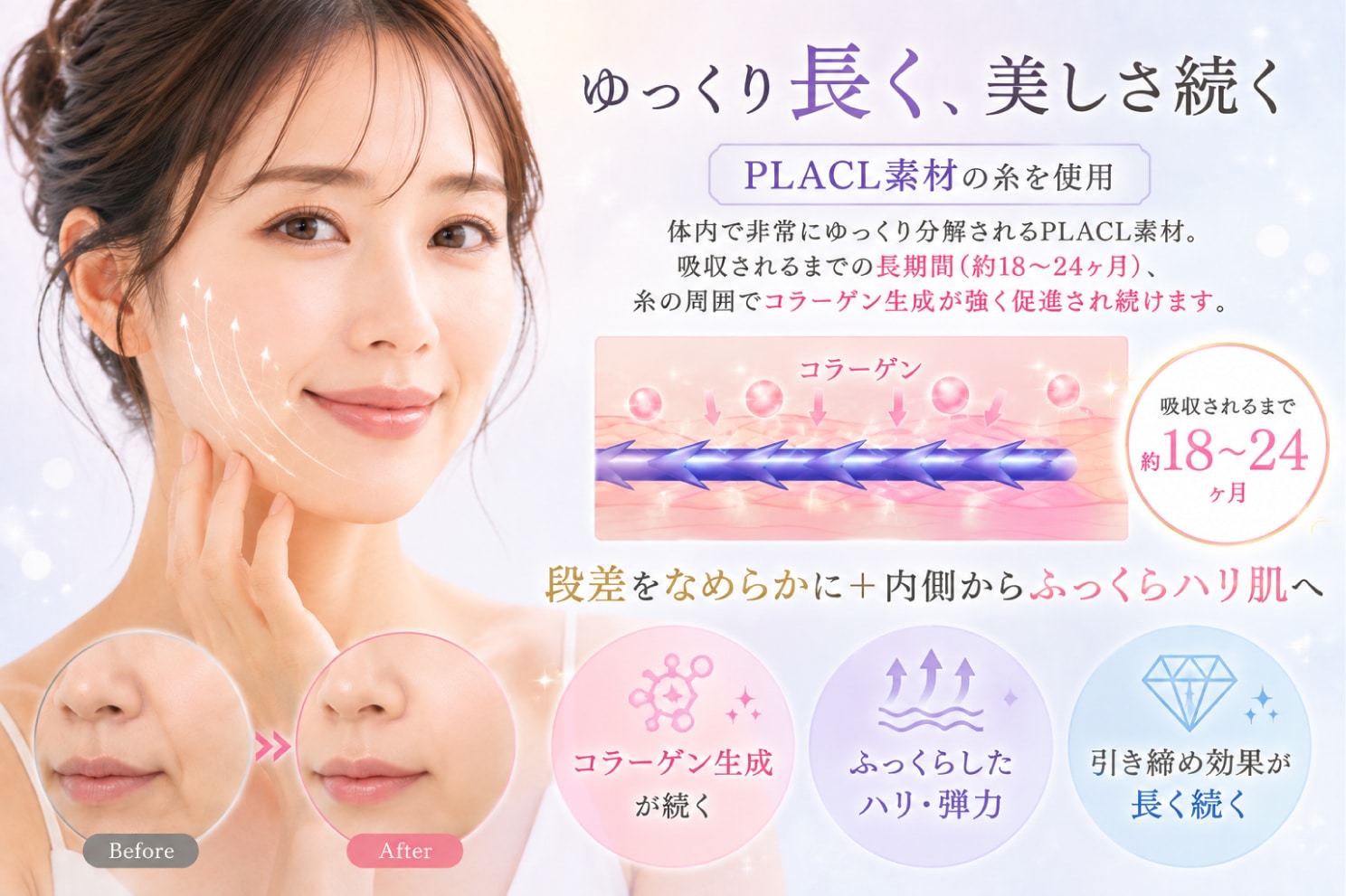 コラーゲン生成 PLACL