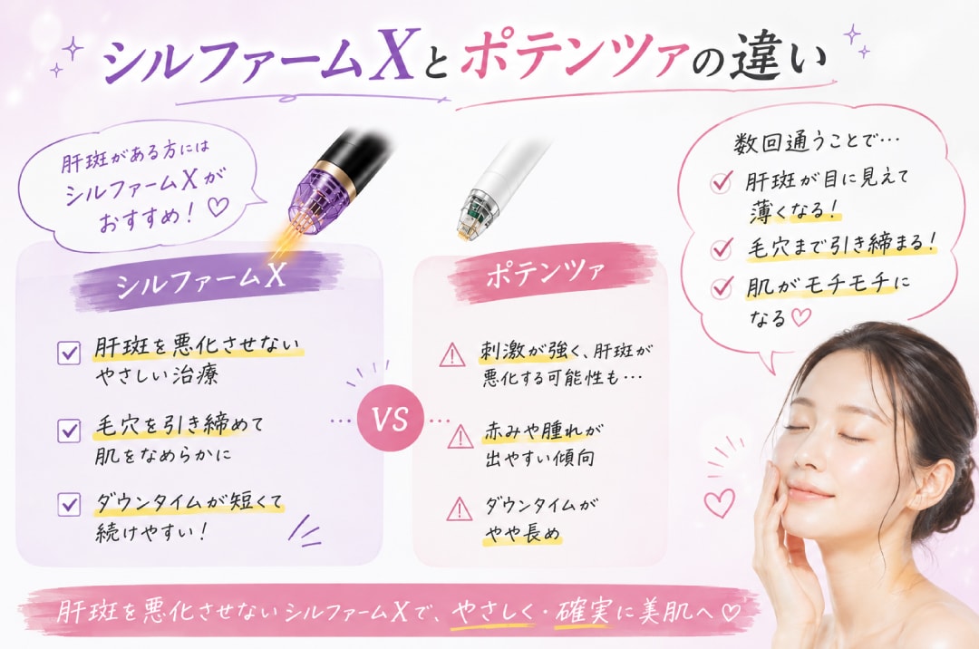シルファームXとポテンツァの違い