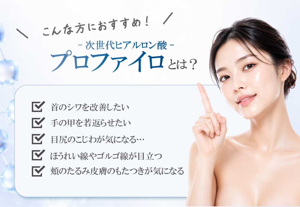プロファイロってなに？
