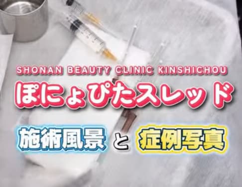 Instagramで症例動画を見る