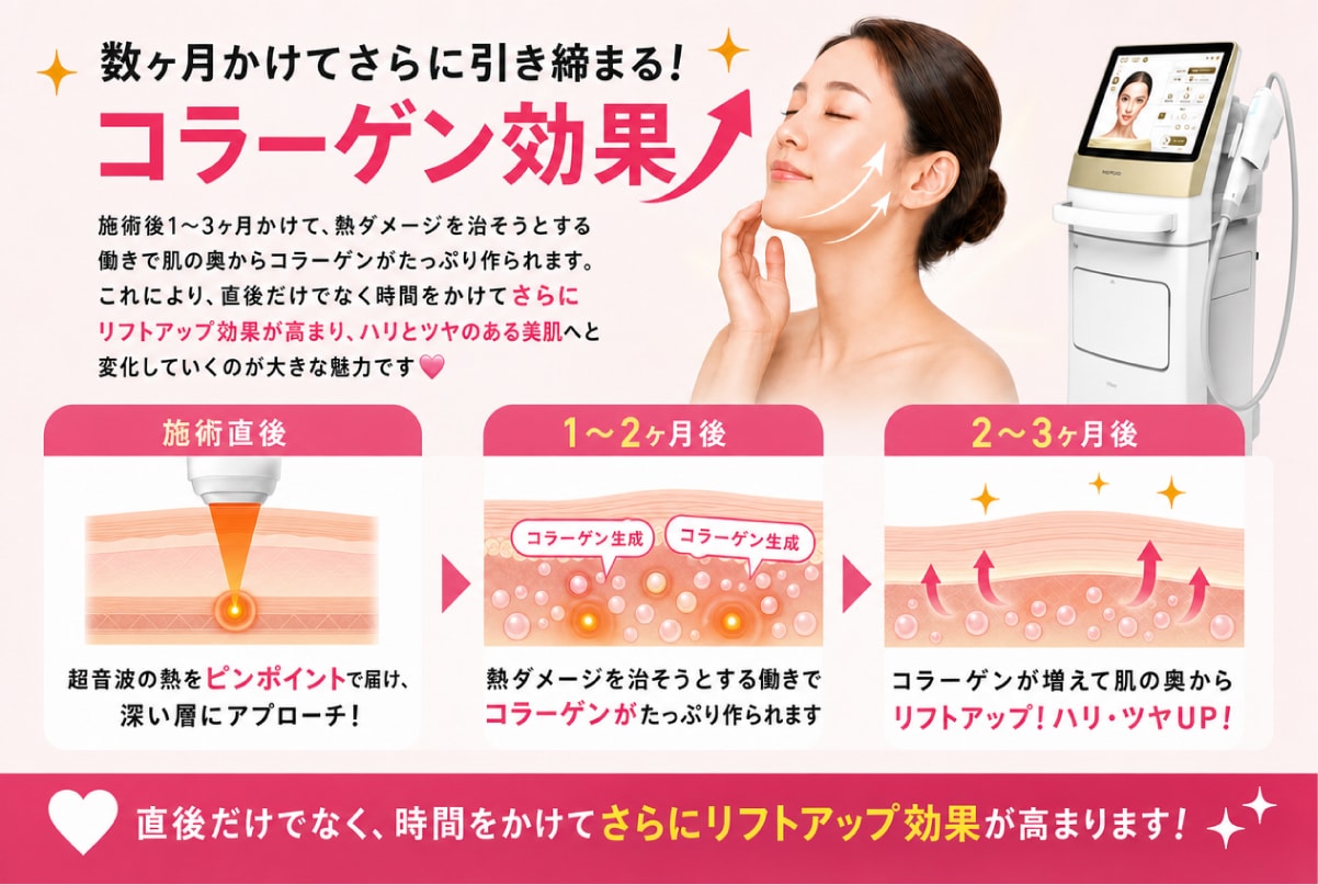 数ヶ月かけてさらに引き締まる！コラーゲン効果