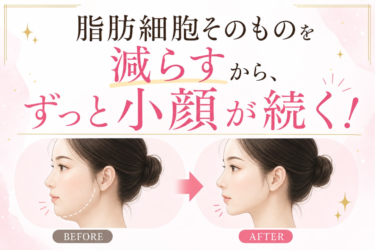 脂肪細胞そのものを減らすから、ずっと小顔が続く！