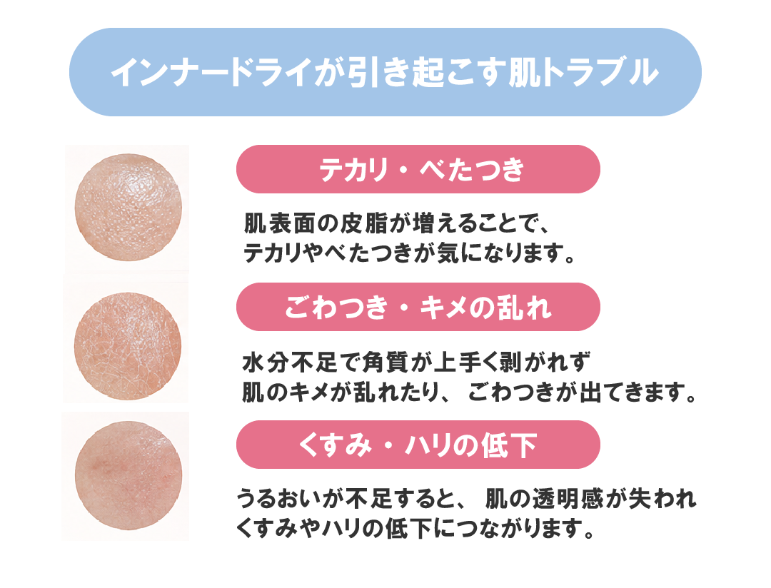 雨の日でなんだか潤ってるかも…は勘違い。<br />
「隠れ乾燥肌」湿度の罠に注意が必要！<br />
