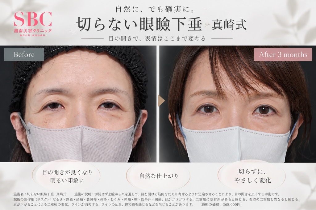 術式の比較