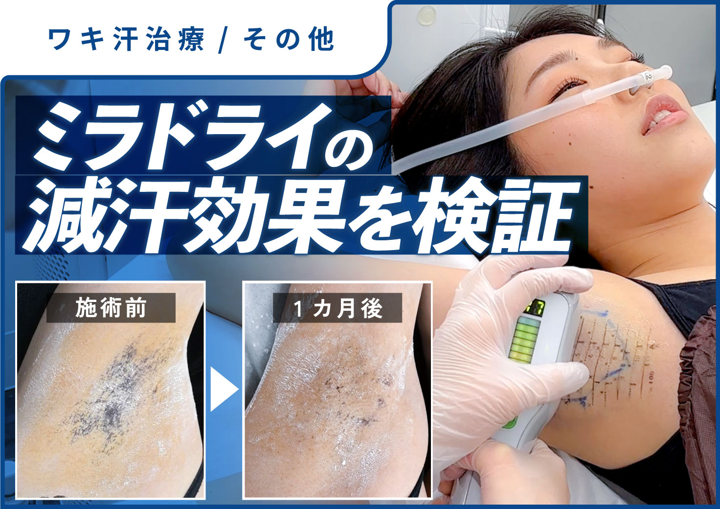 多 汗 症 病院 おすすめ