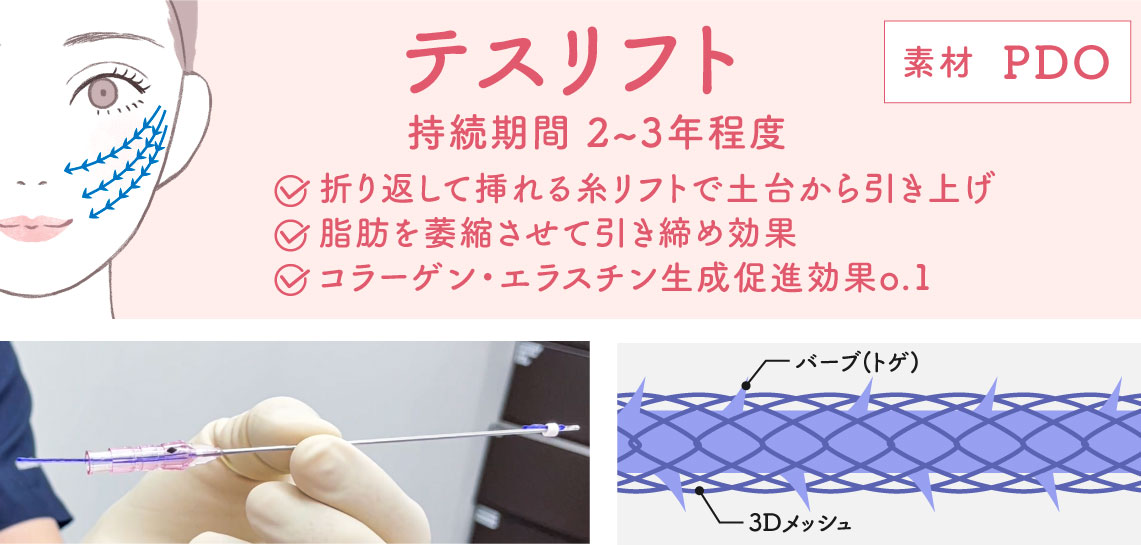 テスリフト