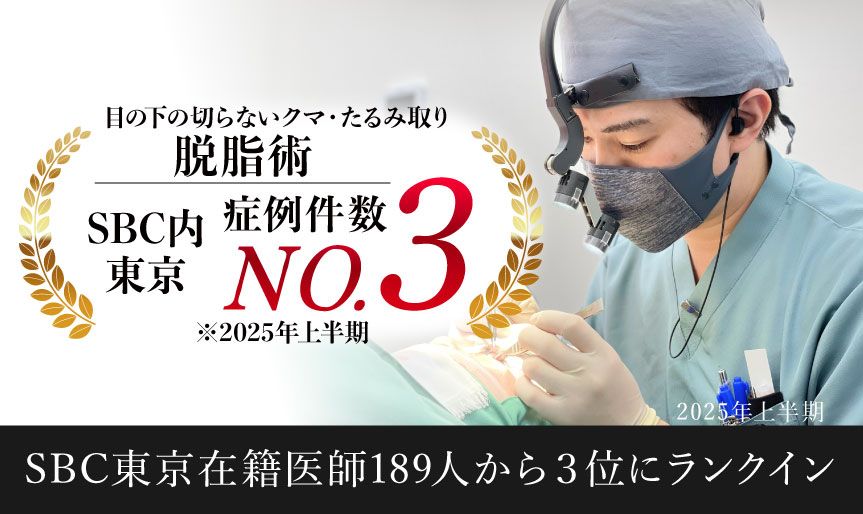 <クマ取り>疲れて見えるふくらみ・色グマ<br />