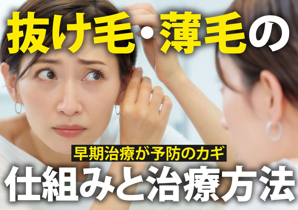 【東京都内で薄毛治療をご検討の方へ】 早期治療がカギ！抜け毛・薄毛治療は湘南美容クリニック北千住院にお任せください