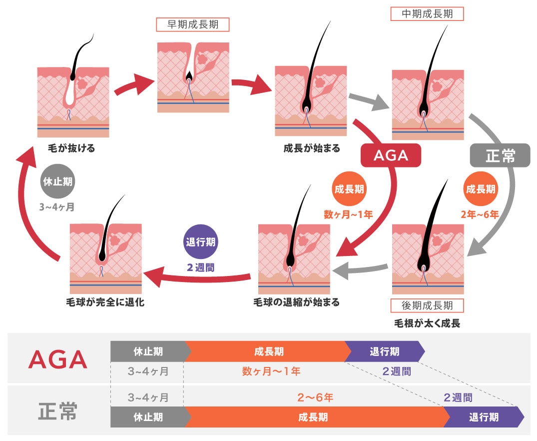 AGA・FAGA共通の仕組みとリスク