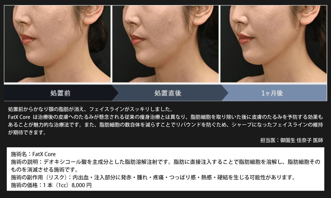 症例