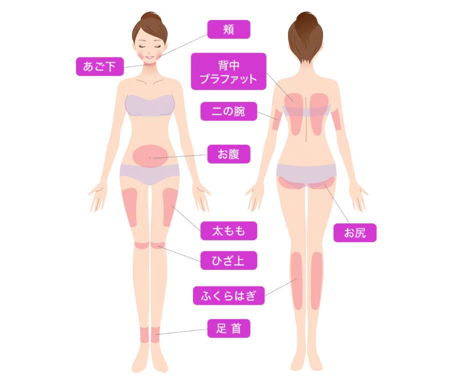 対応部位