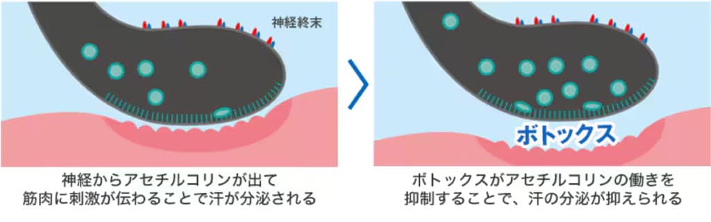 汗が止まるメカニズム