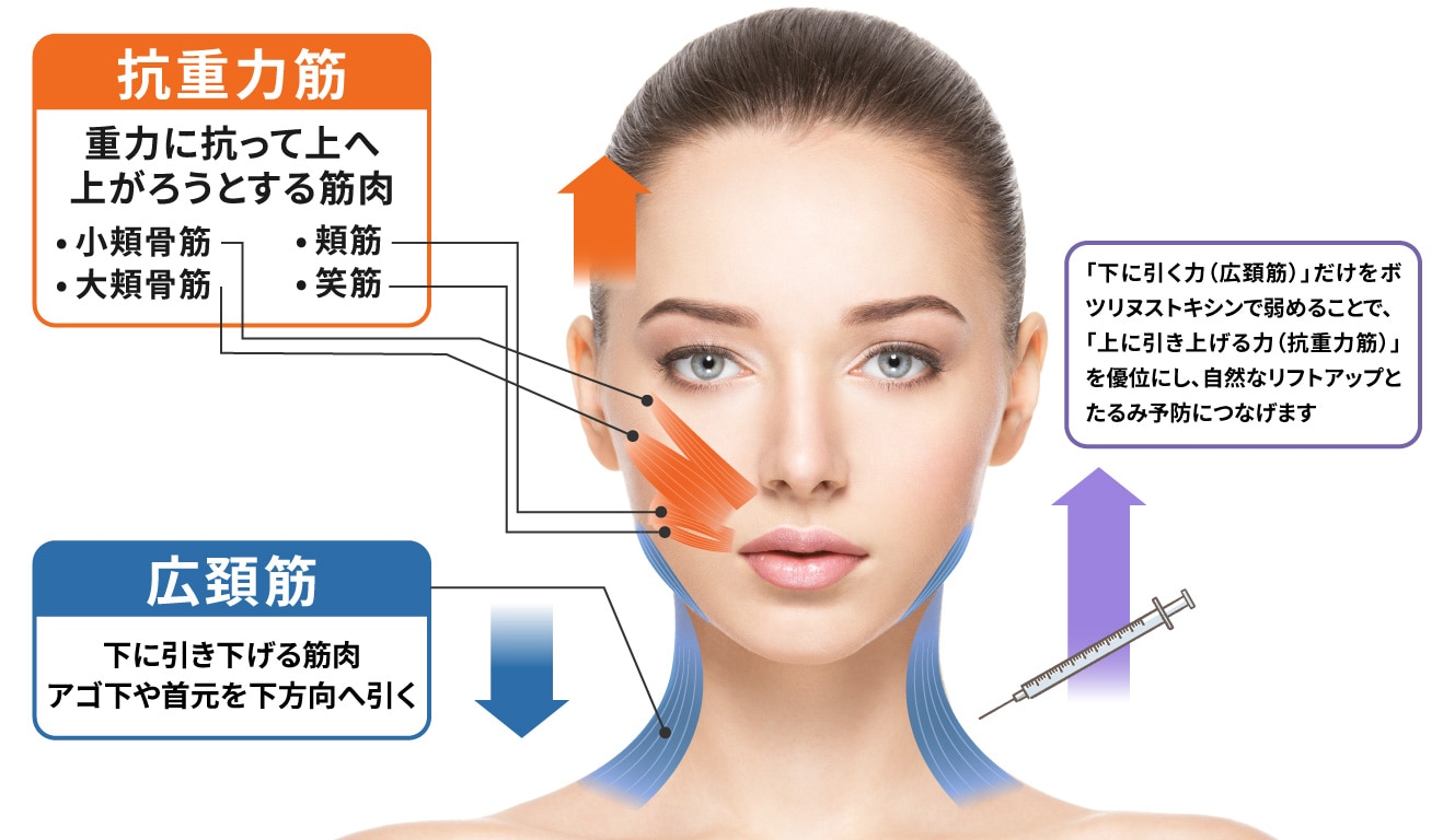 上に引き上げる力(抗重力筋)を優位にする