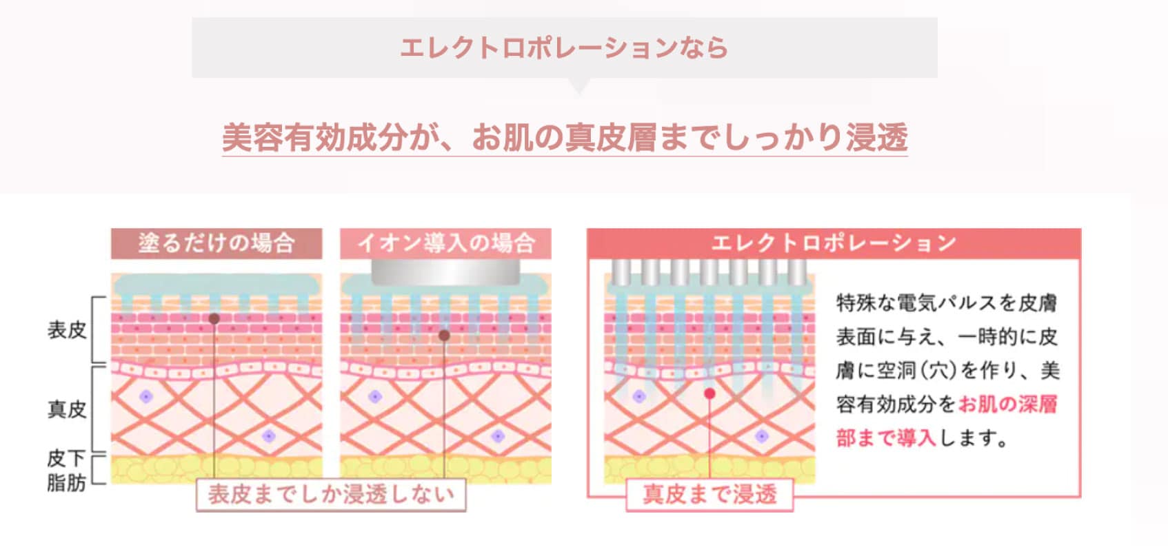 スキンケアではできない美容成分を“奥まで届ける”治療