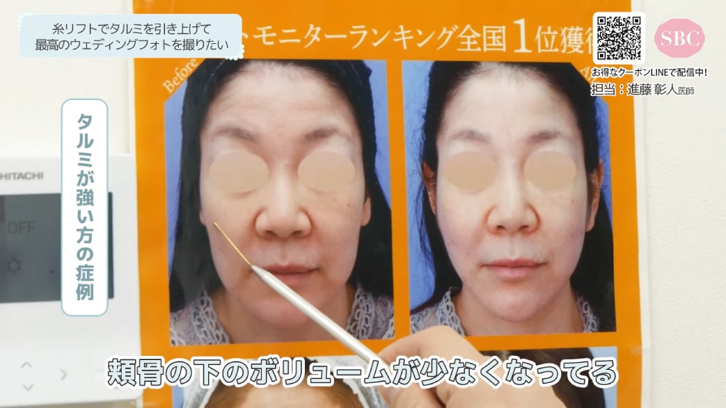 糸の使い方と効果