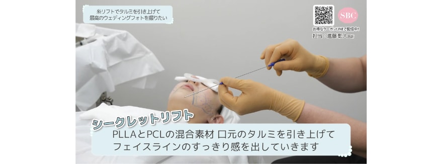 シークレットリフト