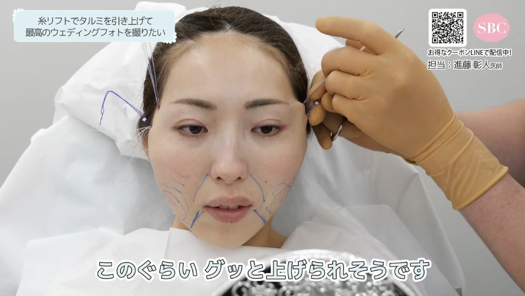 引き上げの調整