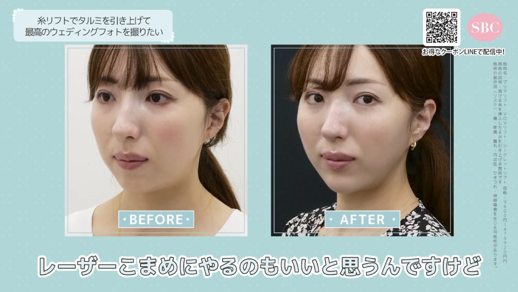 たるみが引き上がり、肌艶もアップ