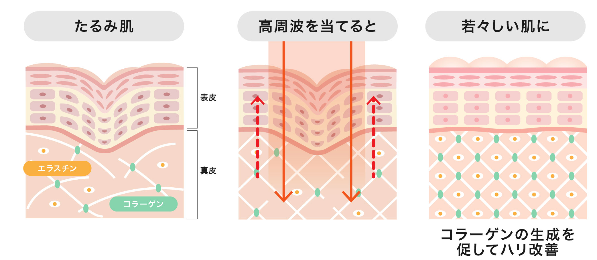 高周波って何がいいの？