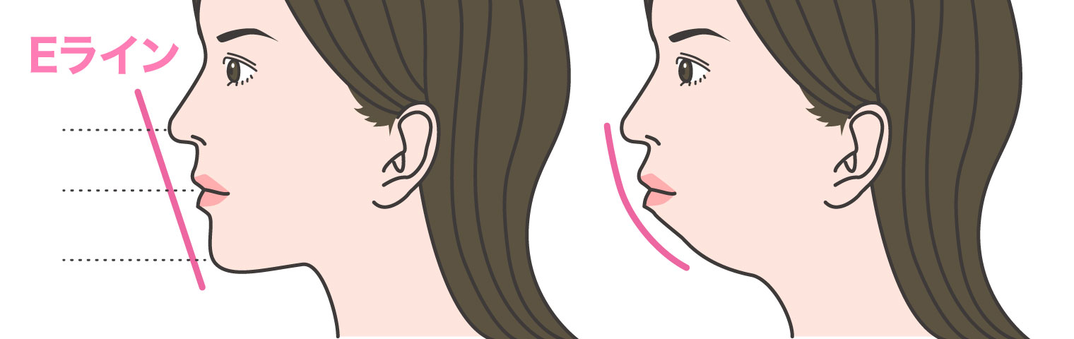 どんな状態を指すのか