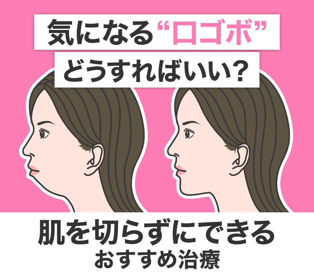 【口ゴボに悩む人必見】肌を切らずに“横顔美人”をつくる方法