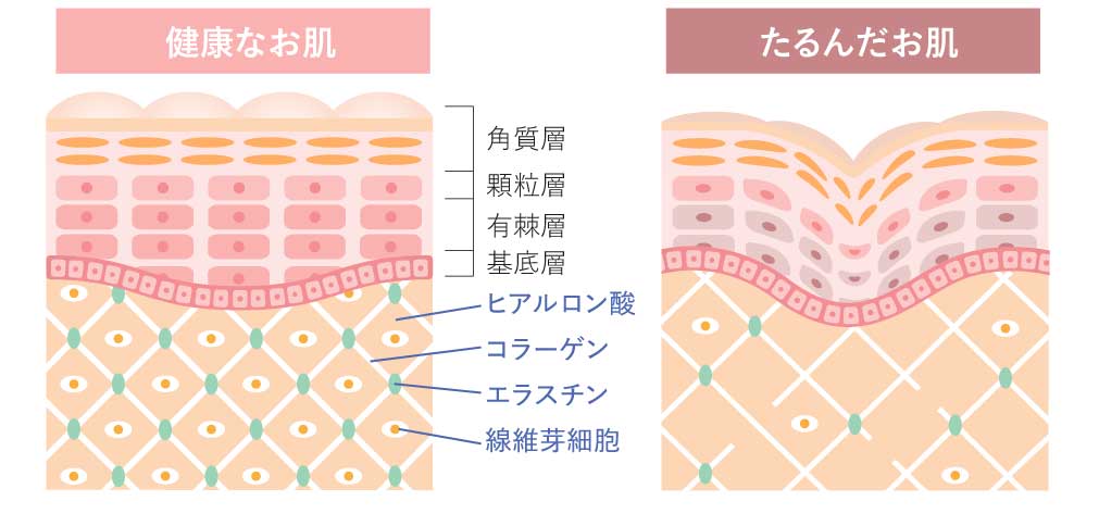 乾燥が“肌のハリ貯金”を一気に減らす