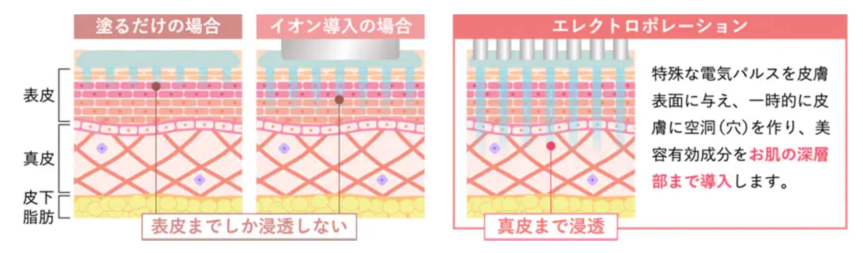《エレクトロポレーション》