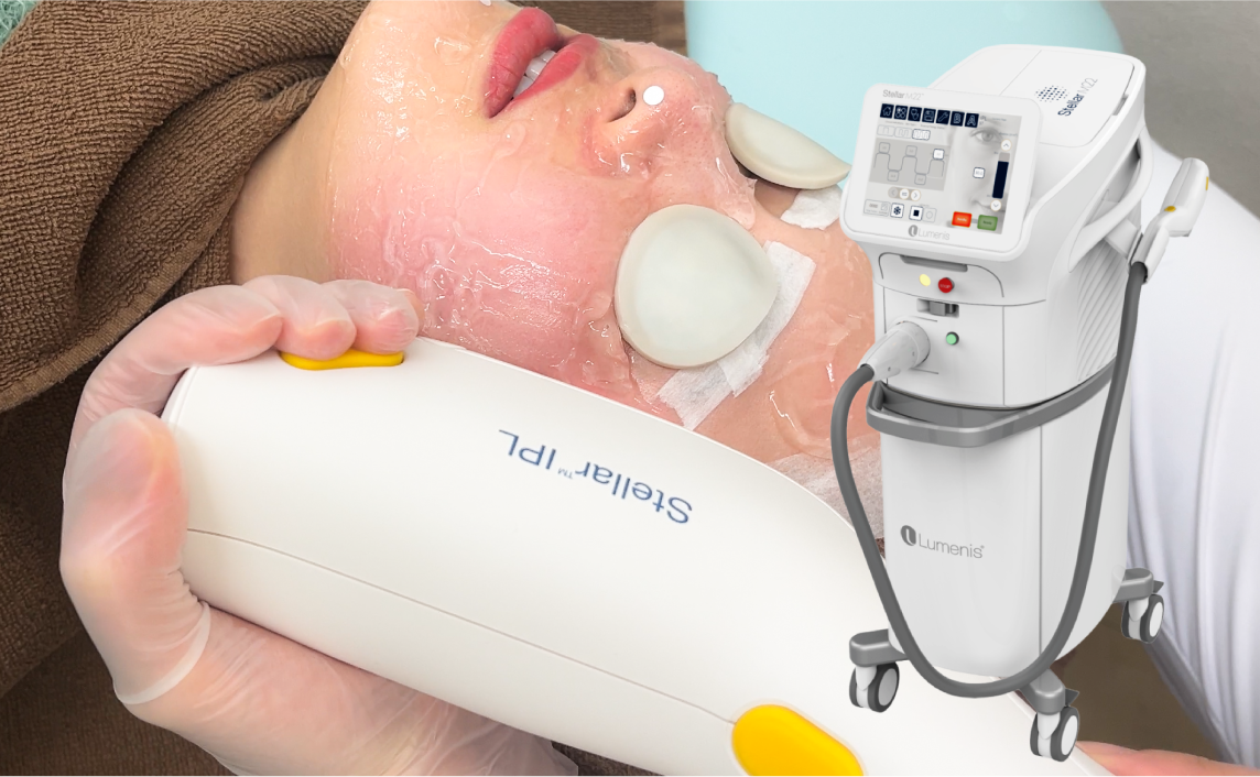 あらゆる肌悩みにアプローチ