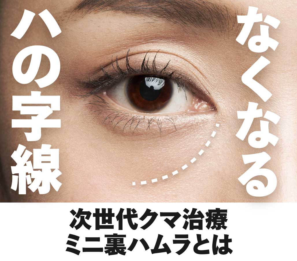 老け見えハの字解消! ミニ裏ハムラが北千住院でも!