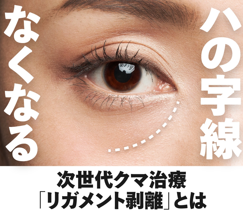 老け見えハの字解消! 「リガメント剥離」が北千住院でも!