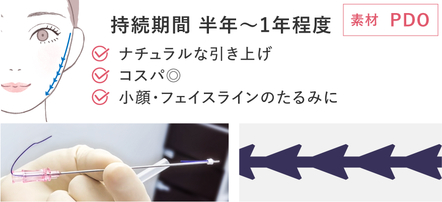 プリマリフト解説